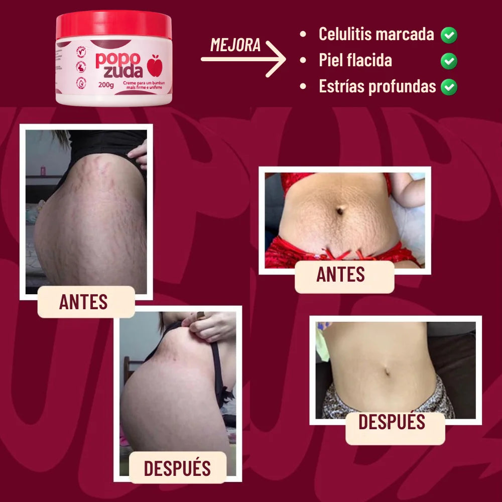 POPOZUDA® | Crema corporal reafirmante, mejora visiblemente la firmeza, textura y apariencia de glúteos, muslos y caderas ✨