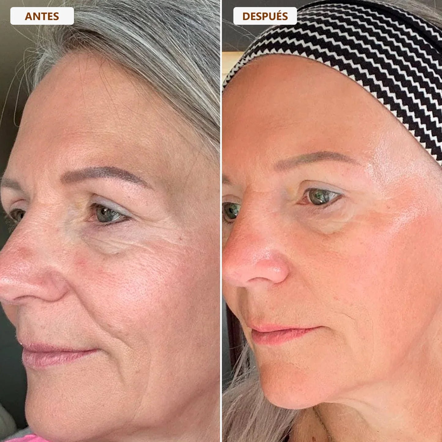 BROCHA FACIAL DRENAJE LINFÁTICO 2x1 | Devuelve el contorno y la suavidad a tu rostro ✨
