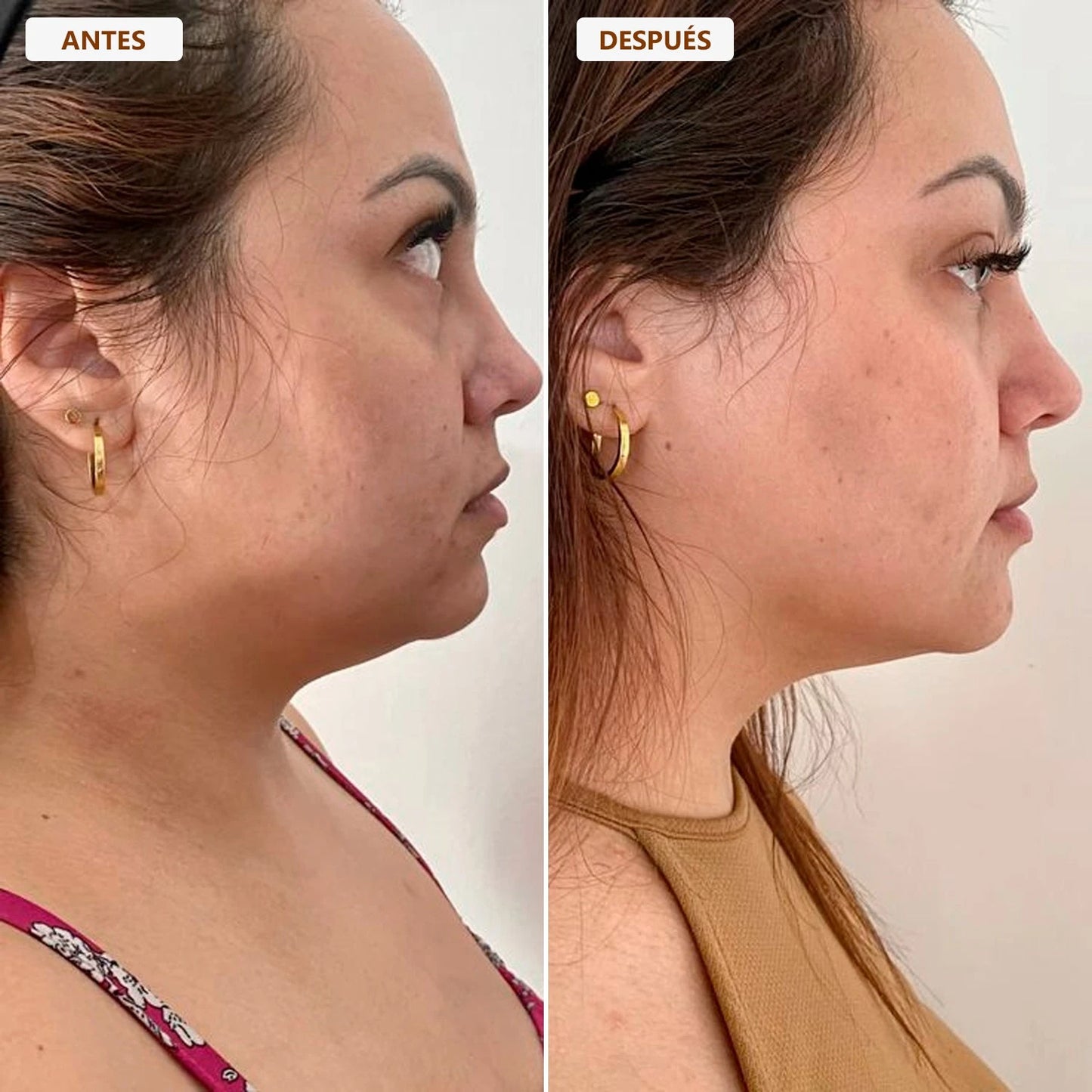 BROCHA FACIAL DRENAJE LINFÁTICO 2x1 | Devuelve el contorno y la suavidad a tu rostro ✨