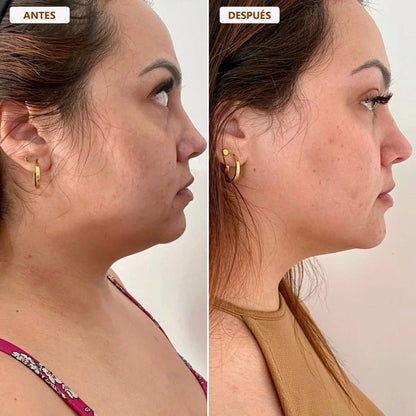 BROCHA FACIAL DRENAJE LINFÁTICO 2x1 | Devuelve el contorno y la suavidad a tu rostro ✨