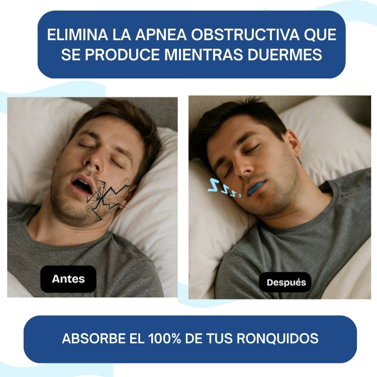 PROTECTOR BUCAL PROMO 2x1 - No más ronquidos, bruxismo o apnea - Descanso completo 💤
