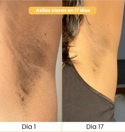 JABON ARTESANAL DE CURCUMA 2x1 - Rutina fácil que remueve manchas en la piel 🧼