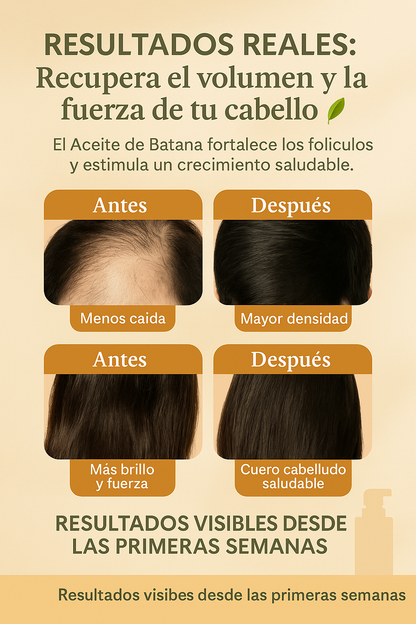 SHAMPOO DE BATANA - Crecimiento y fortaleza garantizada para tu cabello.