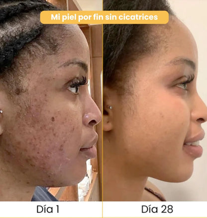 JABON ARTESANAL DE CURCUMA 2x1 - Rutina fácil que remueve manchas en la piel 🧼