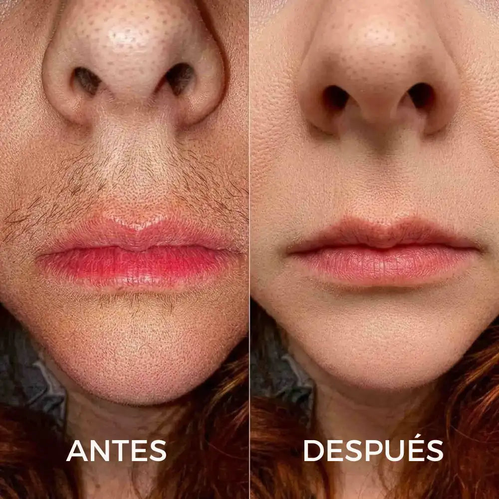 CYPERUS OIL® | Elimina de raíz el vello no deseado ✨