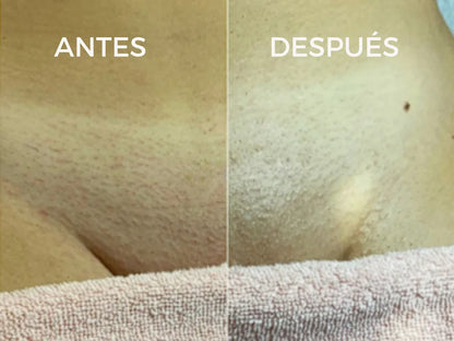 CYPERUS OIL® | Elimina de raíz el vello no deseado ✨