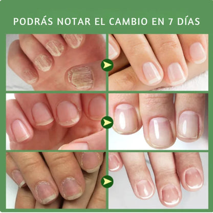 NAIL RESTORE 2x1 | Tratamiento para uñas fuertes, brillantes y renovadas 💅🏻