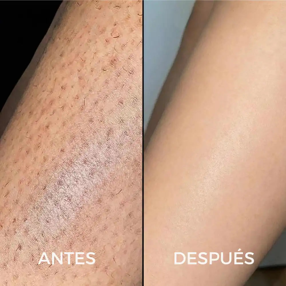 CYPERUS OIL® | Elimina de raíz el vello no deseado ✨